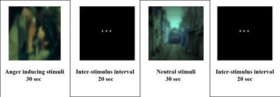 Gray Matter Deficits and Dysfunction in the Insula Among Individuals With Intermittent Explosive Disorder